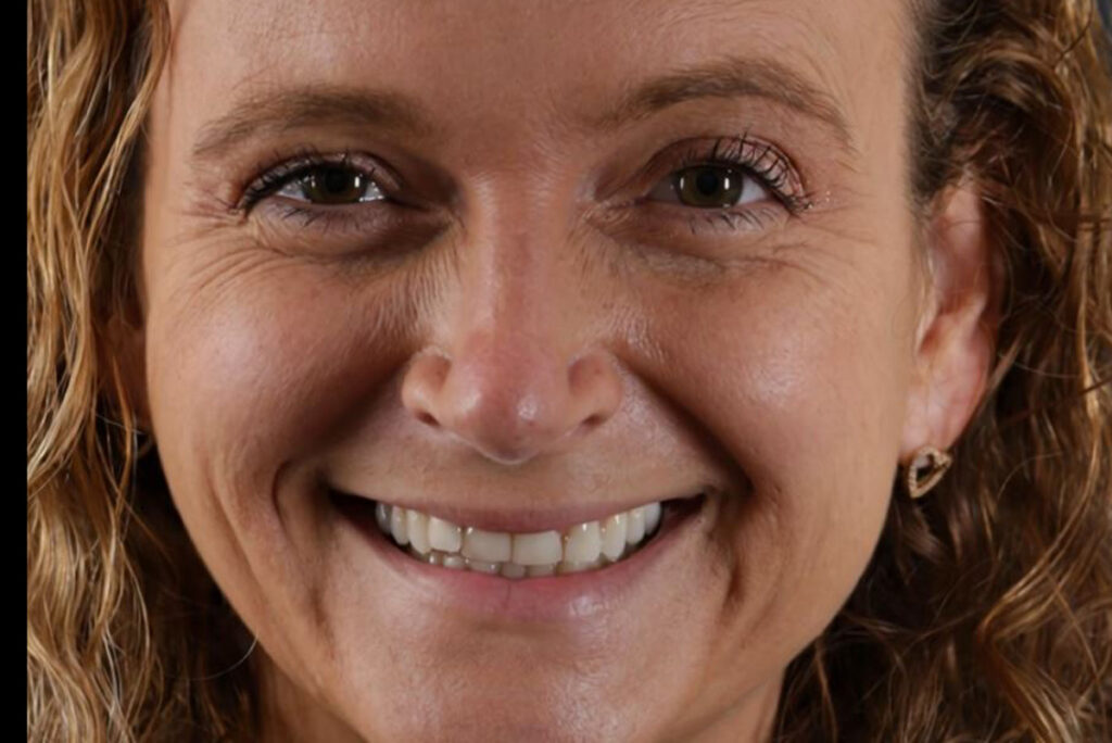 Zahnarzt Paderborn Lächeln von Annika