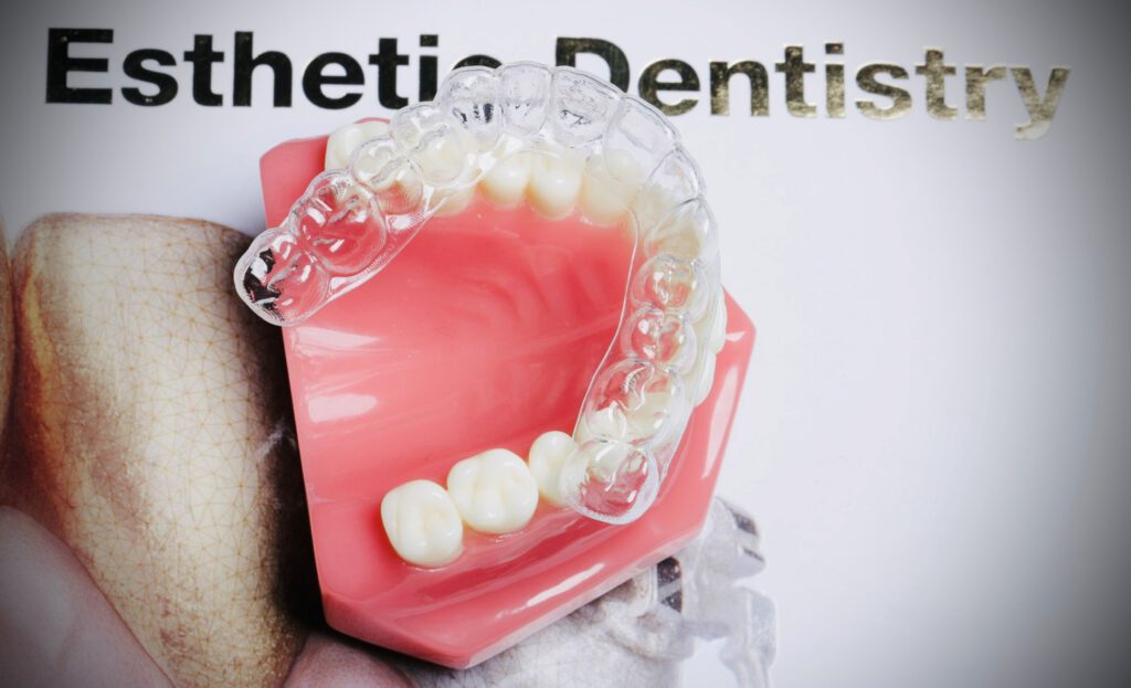 Zahnarzt Paderborn Ästhetik Aligner